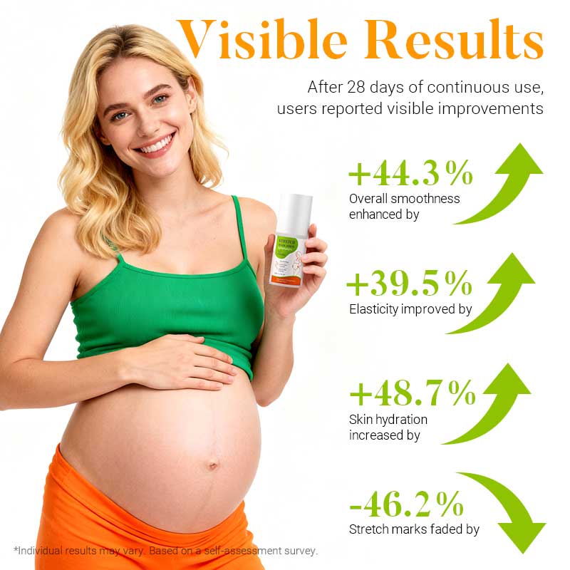 private label stretch mark serum